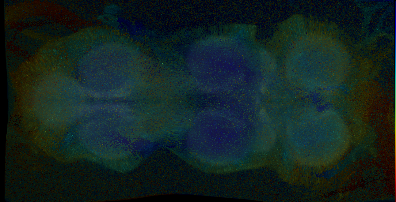 P{GMR17A12-GAL4} expression pattern