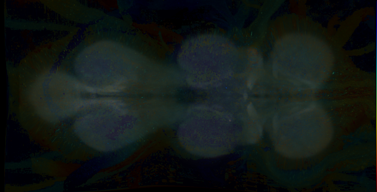 P{GMR17B05-GAL4} expression pattern