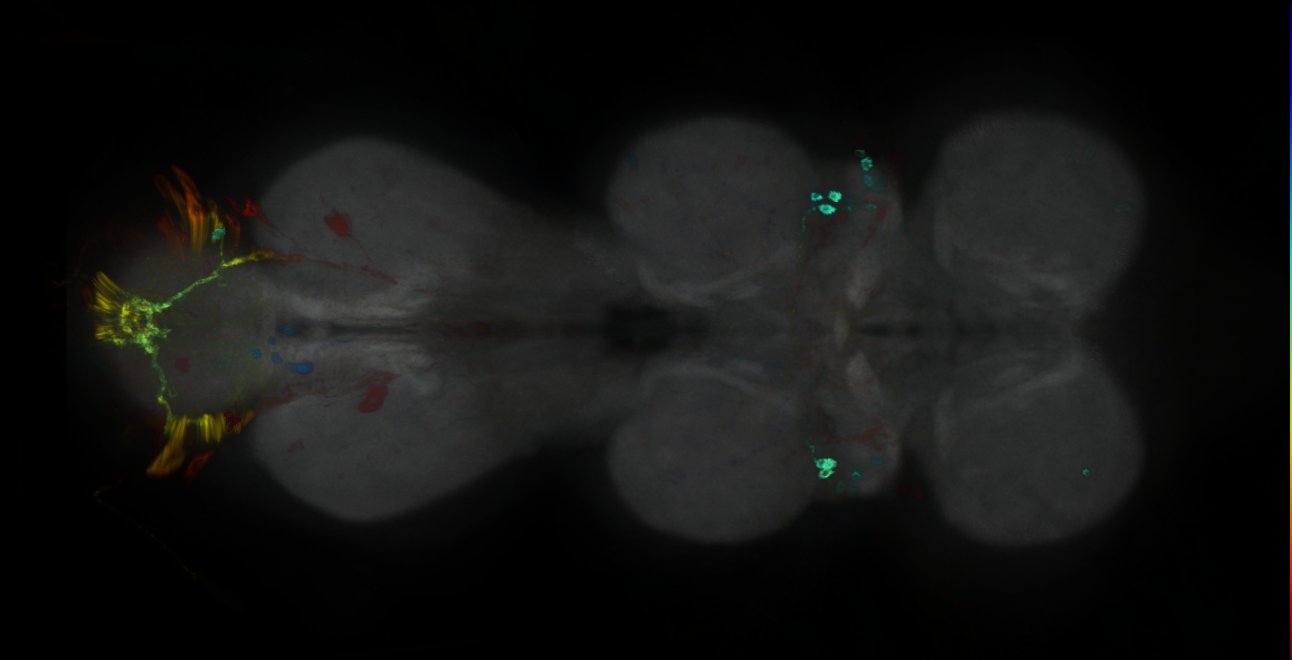 P{GMR17B08-GAL4} expression pattern