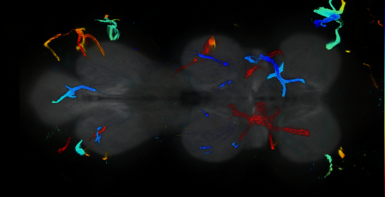 P{GMR17C04-GAL4} expression pattern
