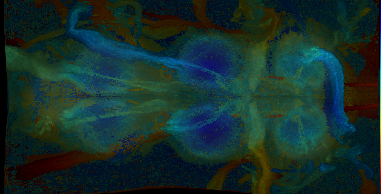 P{GMR17D04-GAL4} expression pattern