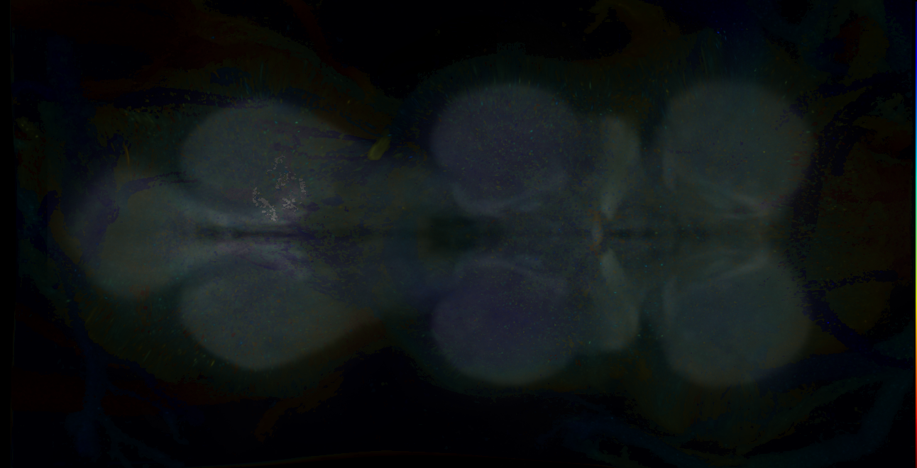 P{GMR17D05-GAL4} expression pattern
