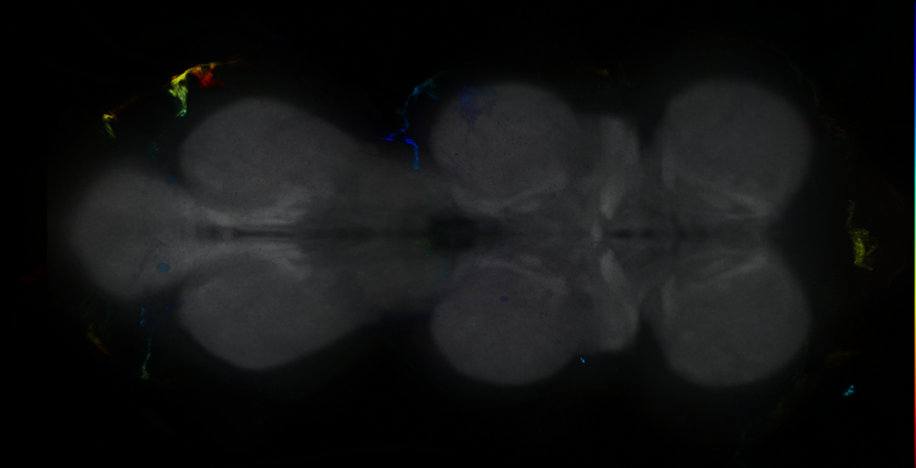 P{GMR17D07-GAL4} expression pattern