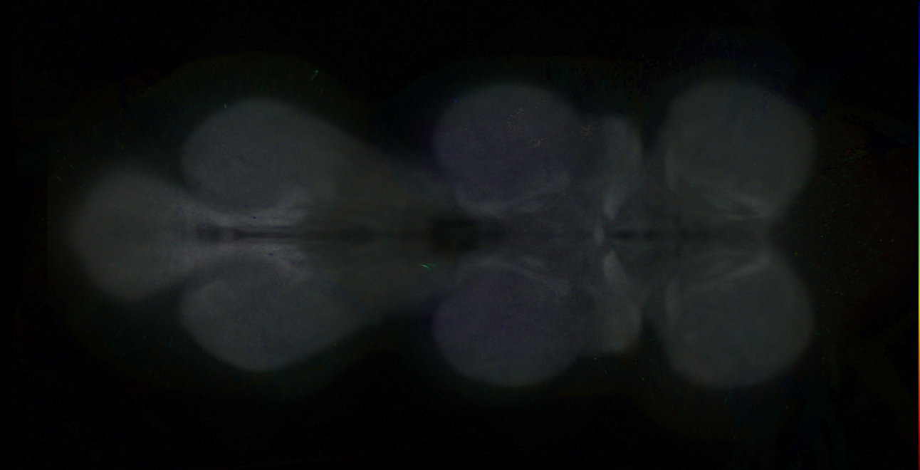 P{GMR17D08-GAL4} expression pattern