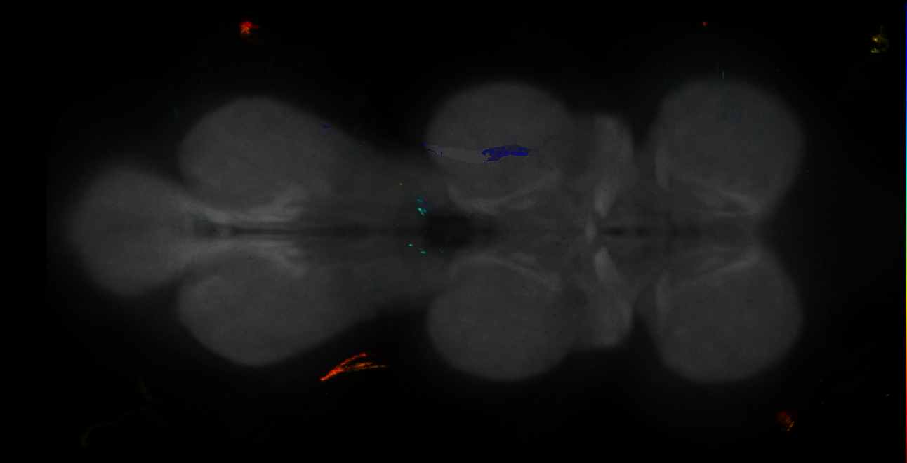 P{GMR17E03-GAL4} expression pattern