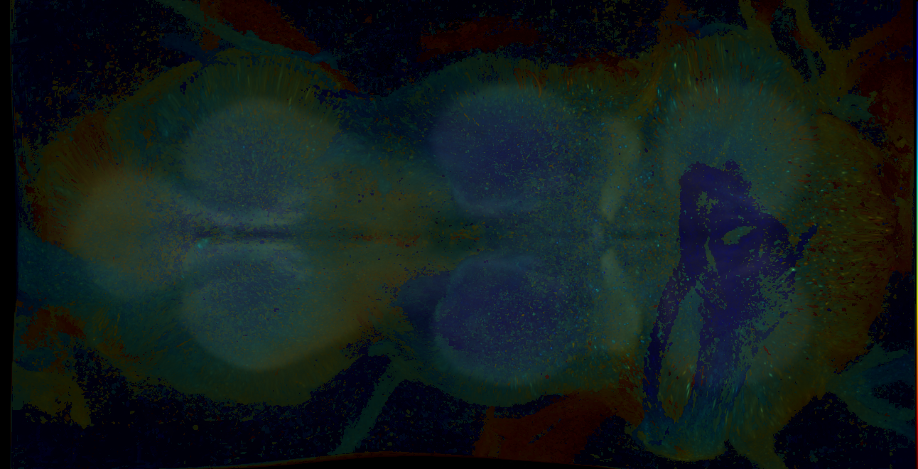P{GMR17E07-GAL4} expression pattern