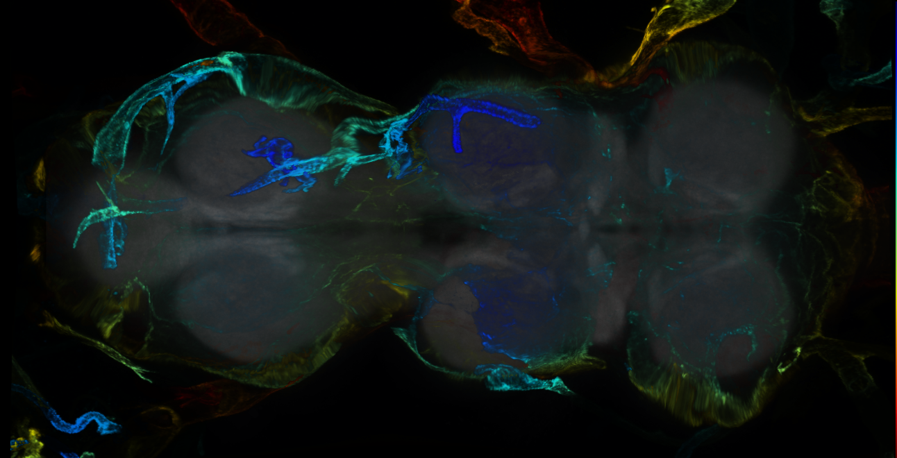 P{GMR17E09-GAL4} expression pattern