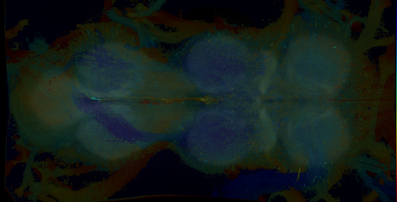 P{GMR17F07-GAL4} expression pattern