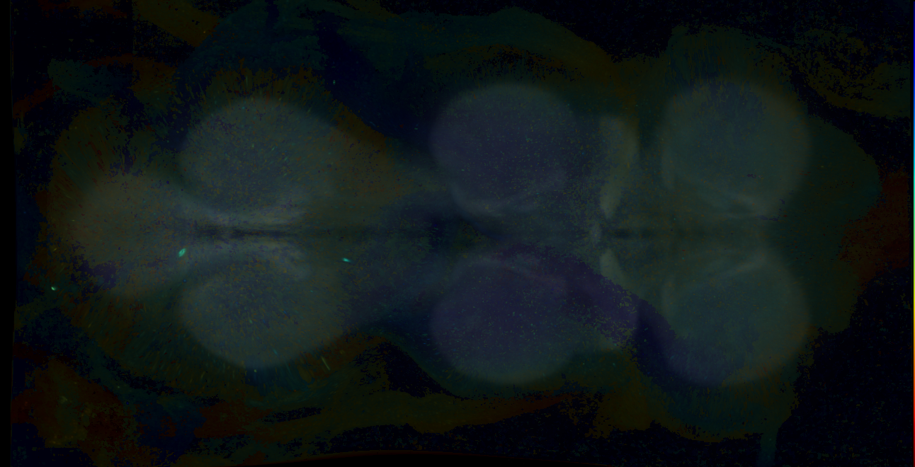 P{GMR17G02-GAL4} expression pattern