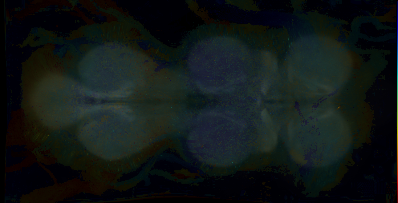 P{GMR17G04-GAL4} expression pattern
