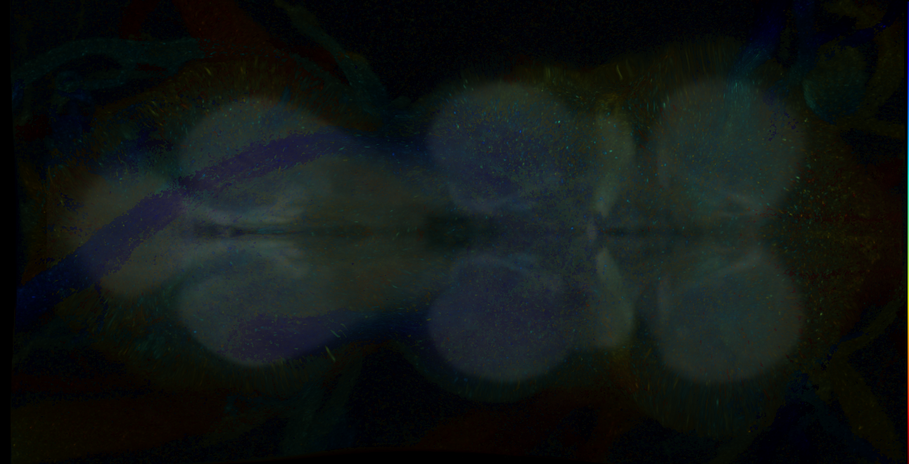 P{GMR17G08-GAL4} expression pattern
