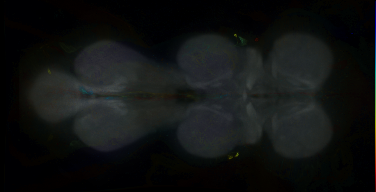 P{GMR17G11-GAL4} expression pattern