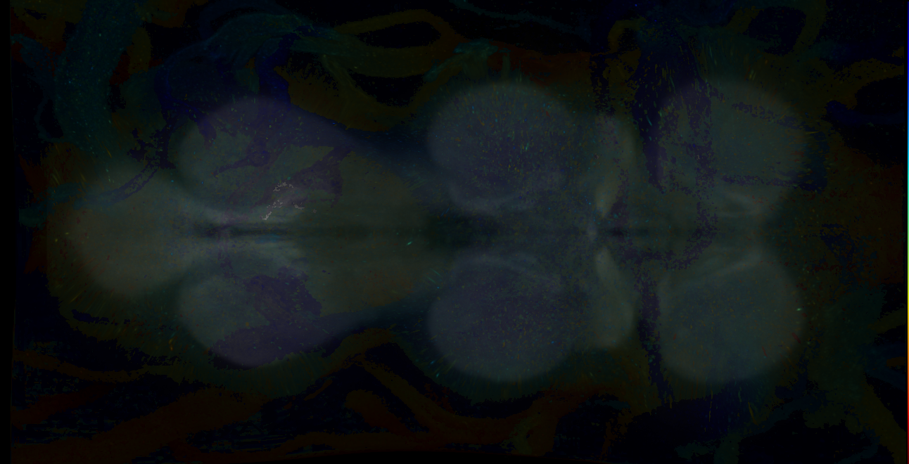 P{GMR17G12-GAL4} expression pattern