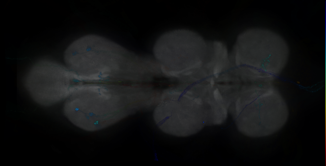 P{GMR17H02-GAL4} expression pattern