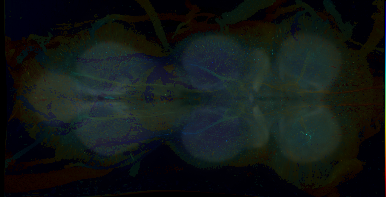 P{GMR17H03-GAL4} expression pattern