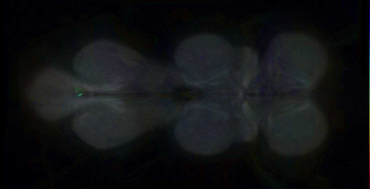 P{GMR17H04-GAL4} expression pattern