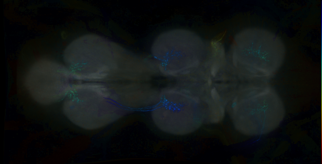 P{GMR17H06-GAL4} expression pattern