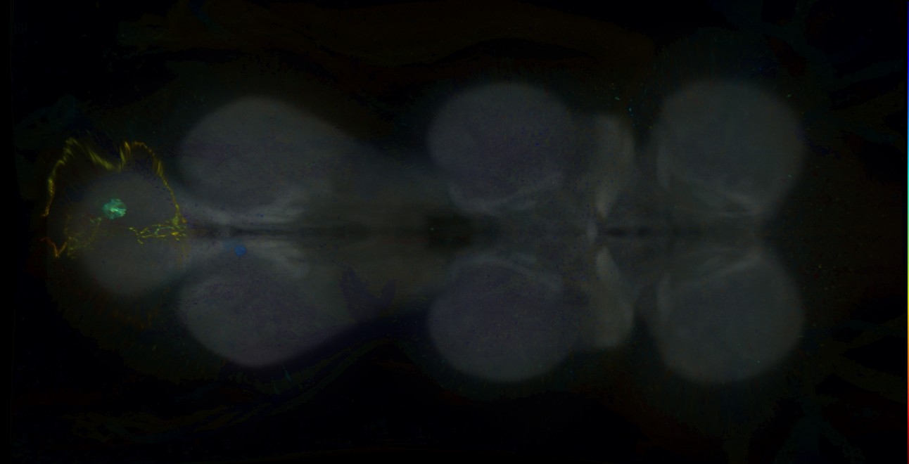 P{GMR17H07-GAL4} expression pattern