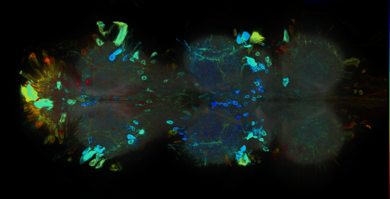 P{GMR17H10-GAL4} expression pattern