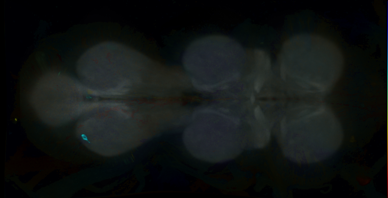 P{GMR17H11-GAL4} expression pattern