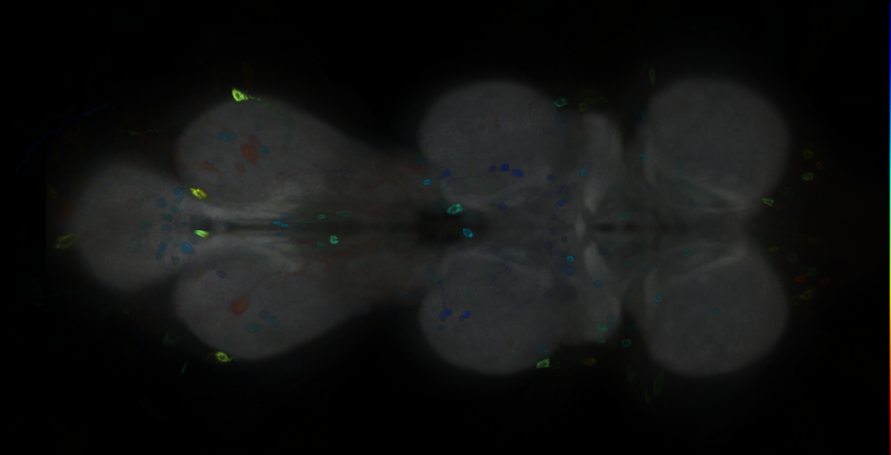 P{GMR18A01-GAL4} expression pattern