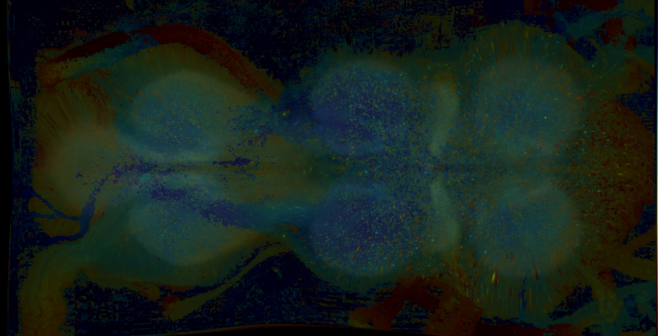 P{GMR18A02-GAL4} expression pattern