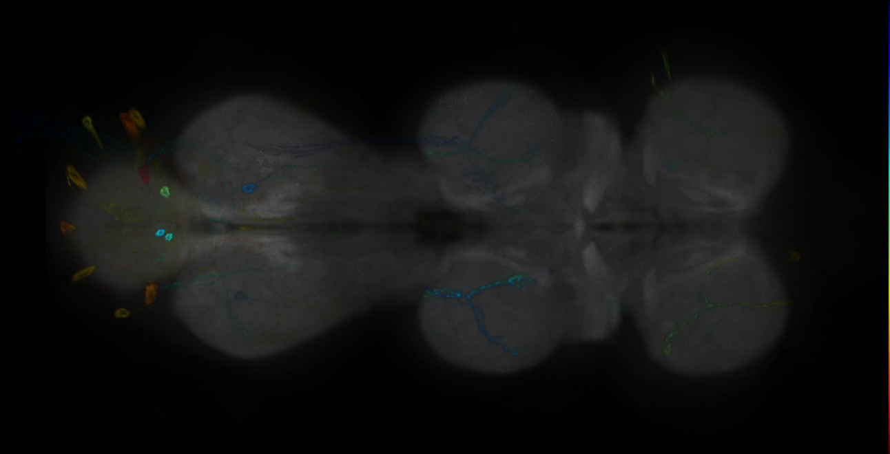 P{GMR18A03-GAL4} expression pattern