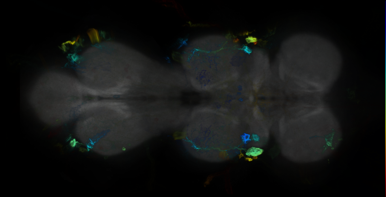 P{GMR18A05-GAL4} expression pattern
