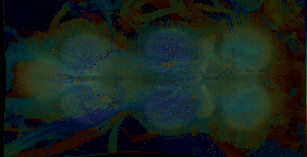P{GMR18A06-GAL4} expression pattern