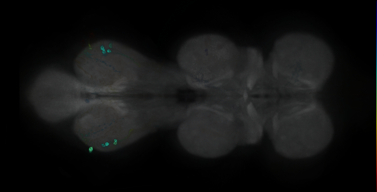 P{GMR18A07-GAL4} expression pattern
