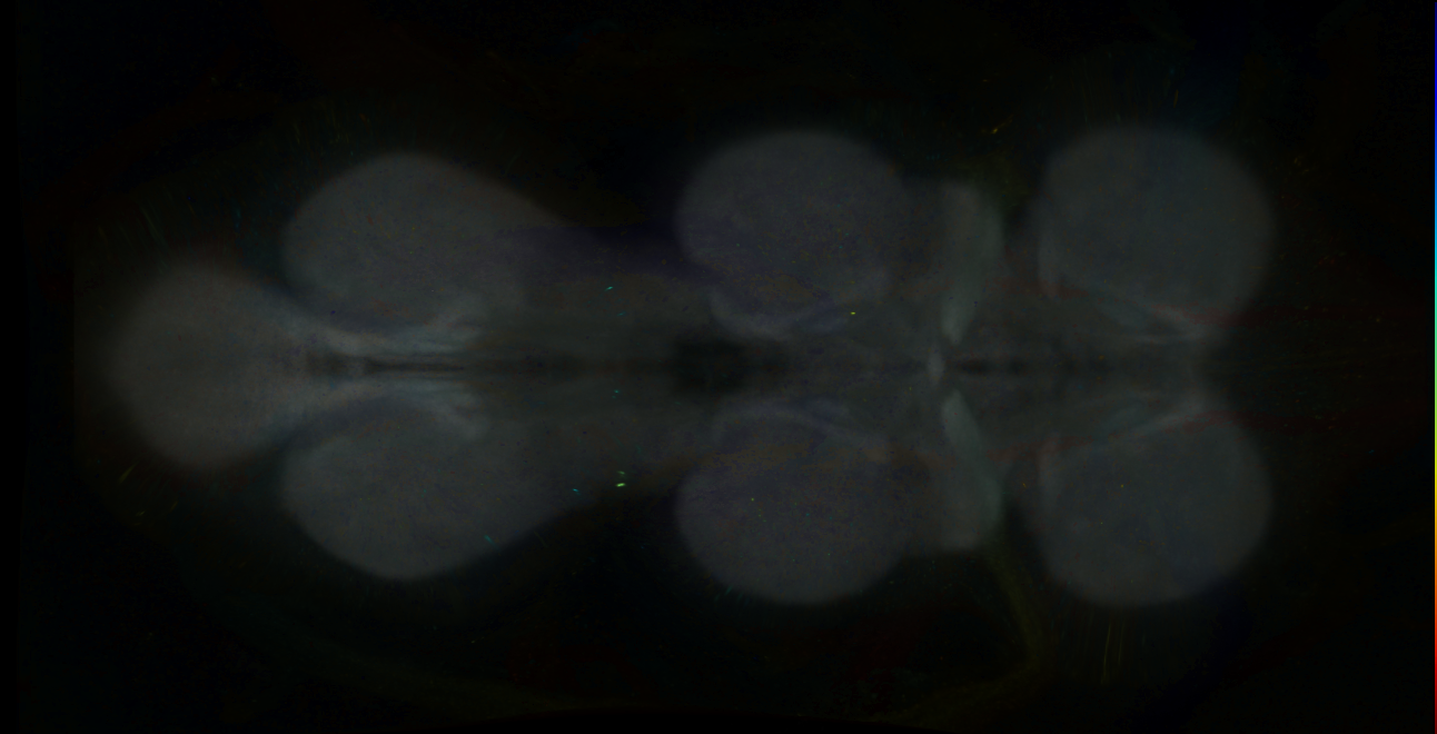 P{GMR18A09-GAL4} expression pattern