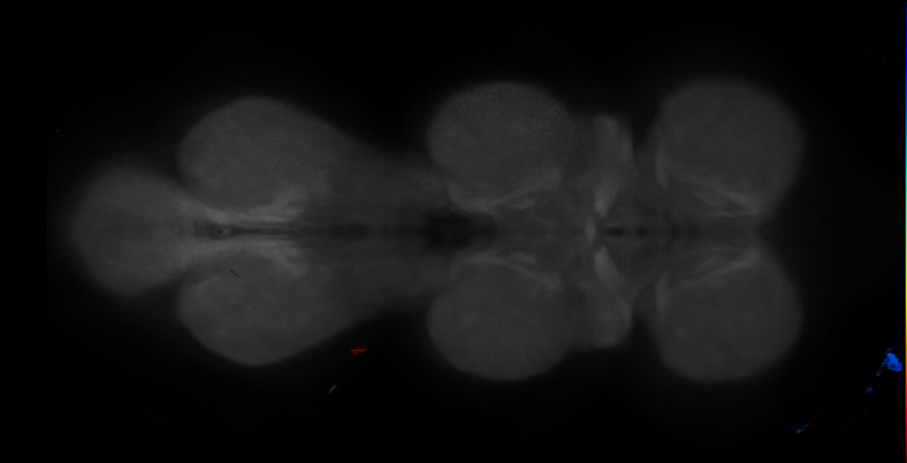 P{GMR18A10-GAL4} expression pattern
