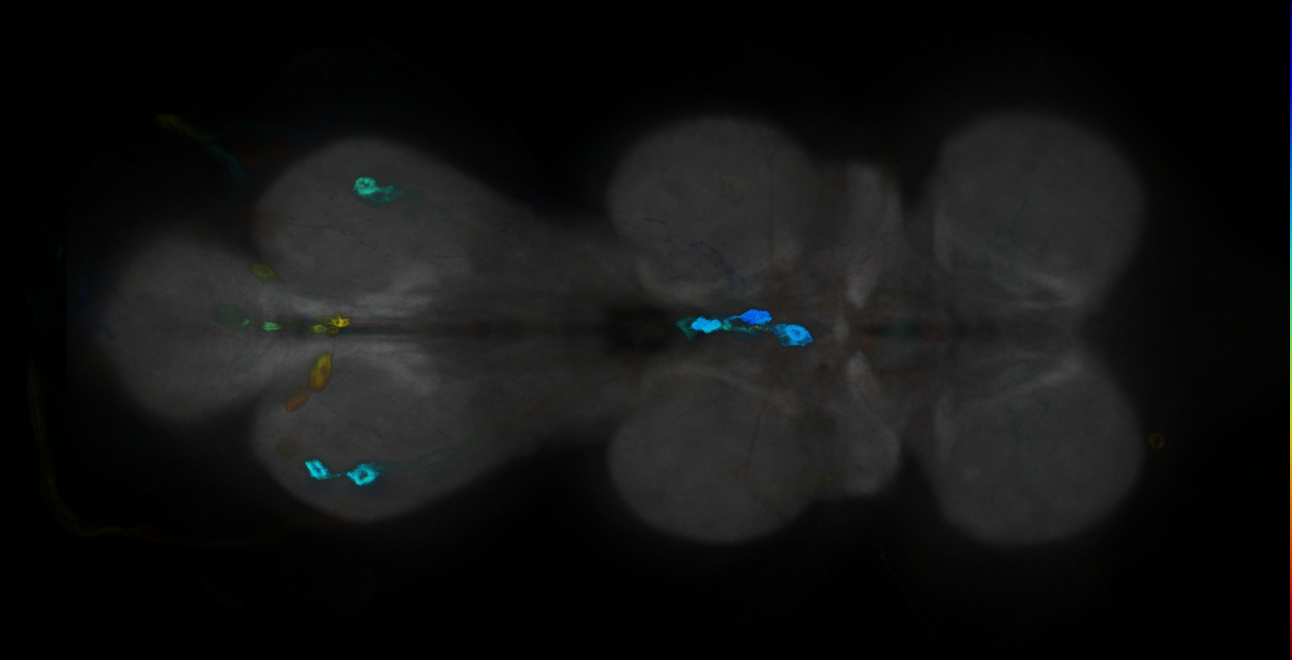 P{GMR18A12-GAL4} expression pattern