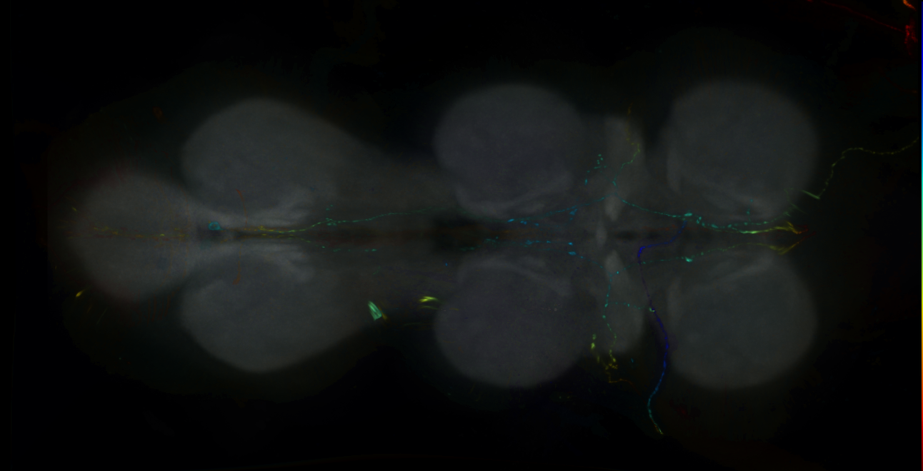 P{GMR18B03-GAL4} expression pattern