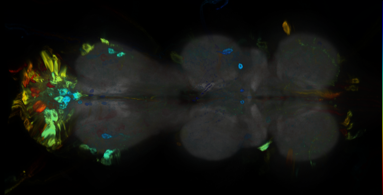 P{GMR18B07-GAL4} expression pattern