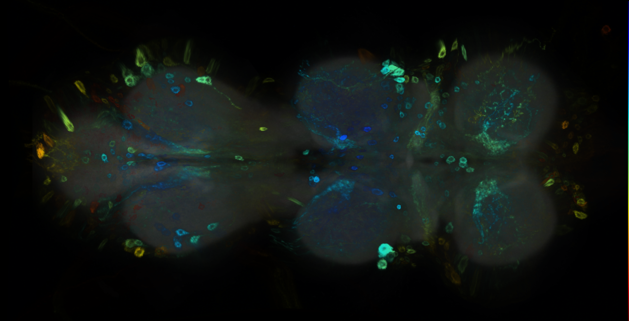 P{GMR18B08-GAL4} expression pattern