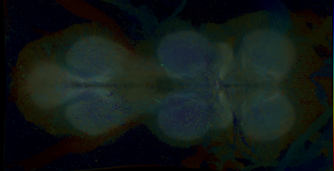 P{GMR18C02-GAL4} expression pattern