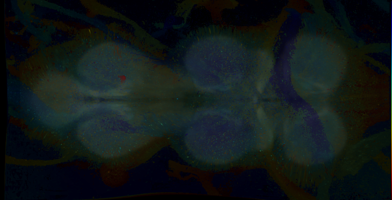 P{GMR18C03-GAL4} expression pattern