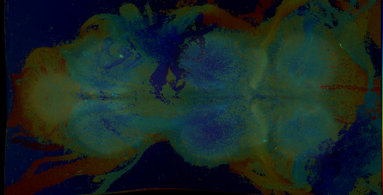 P{GMR18C04-GAL4} expression pattern
