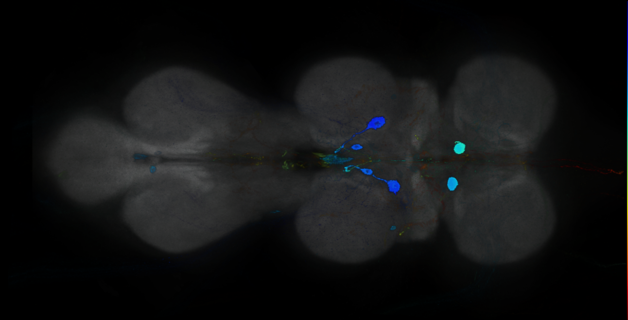 P{GMR18C05-GAL4} expression pattern
