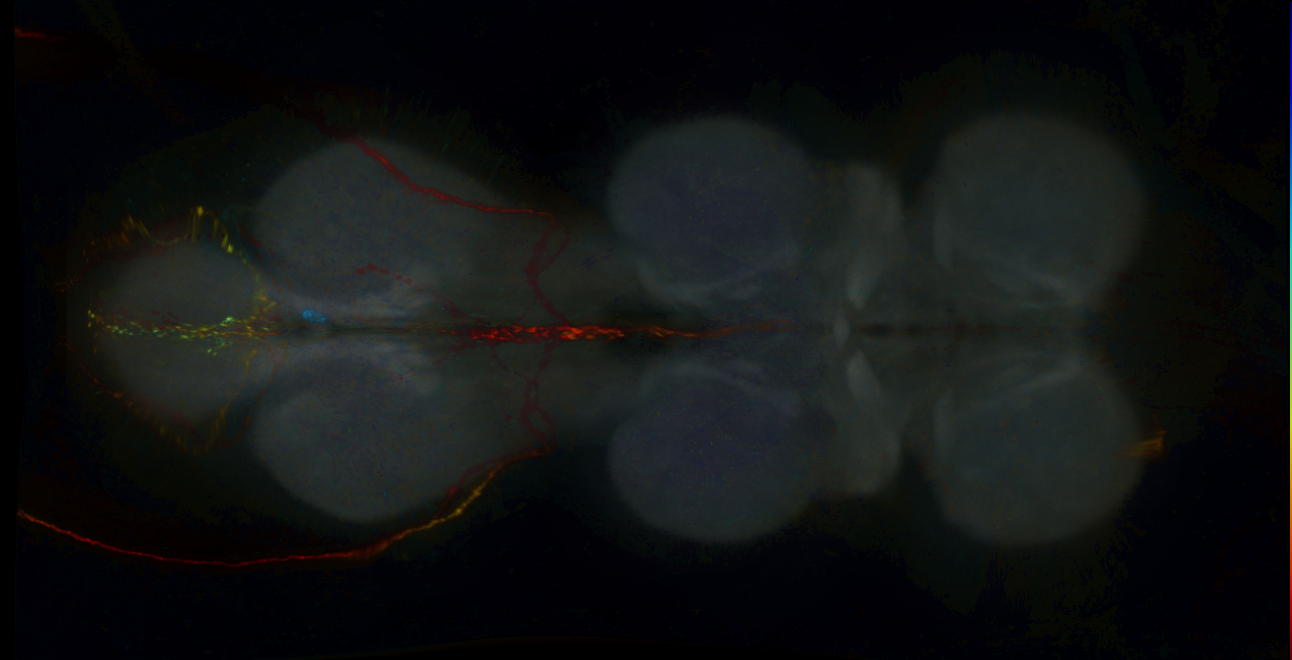 P{GMR18C09-GAL4} expression pattern