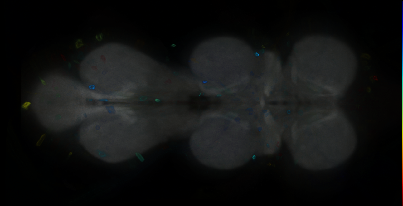 P{GMR18C10-GAL4} expression pattern