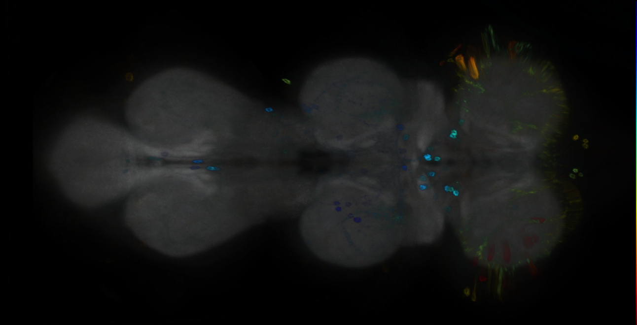 P{GMR18D01-GAL4} expression pattern
