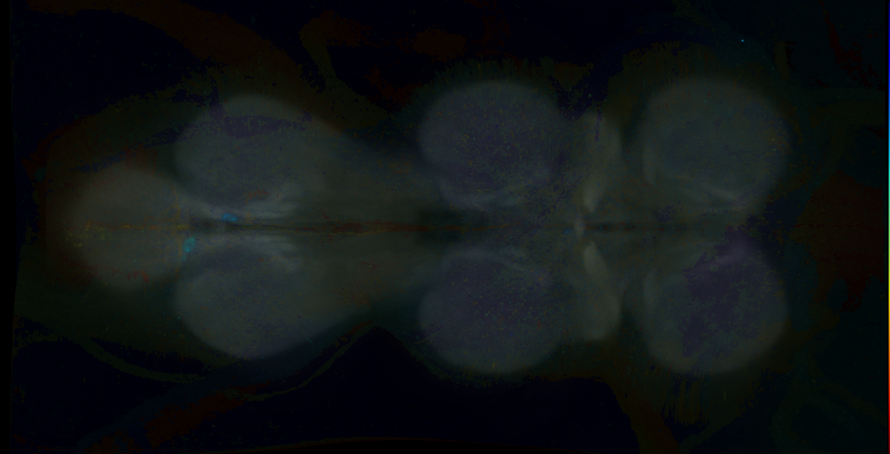P{GMR18D02-GAL4} expression pattern