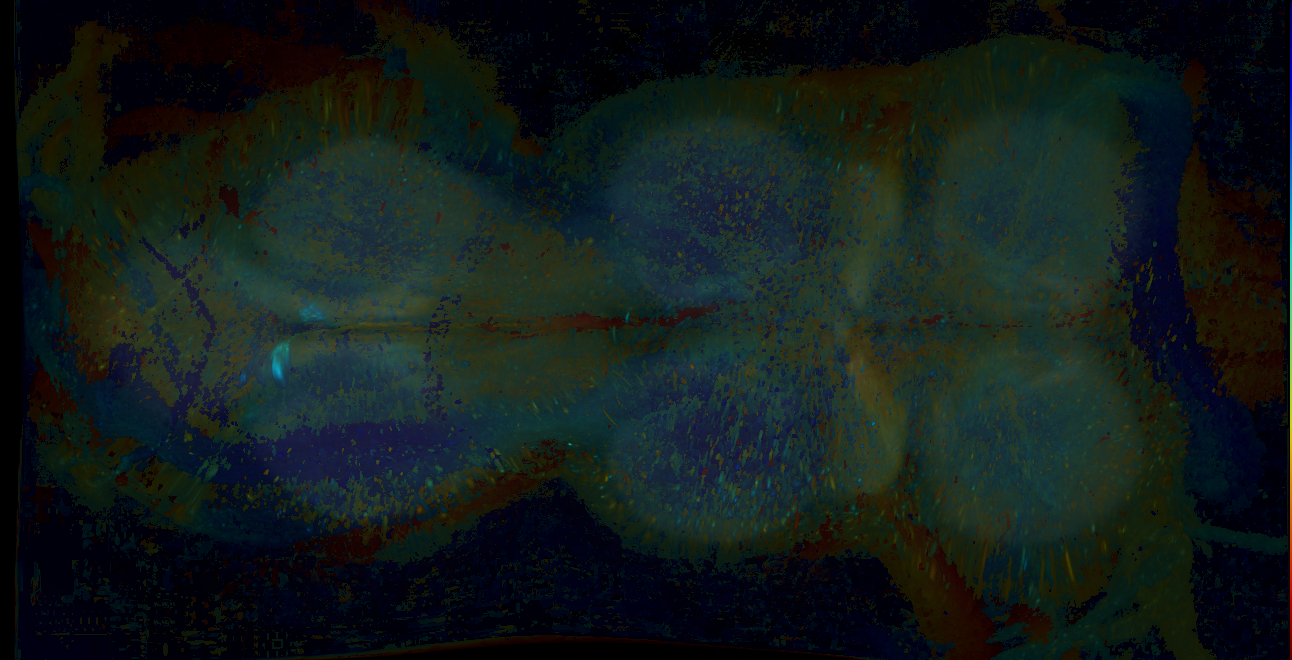 P{GMR18D06-GAL4} expression pattern