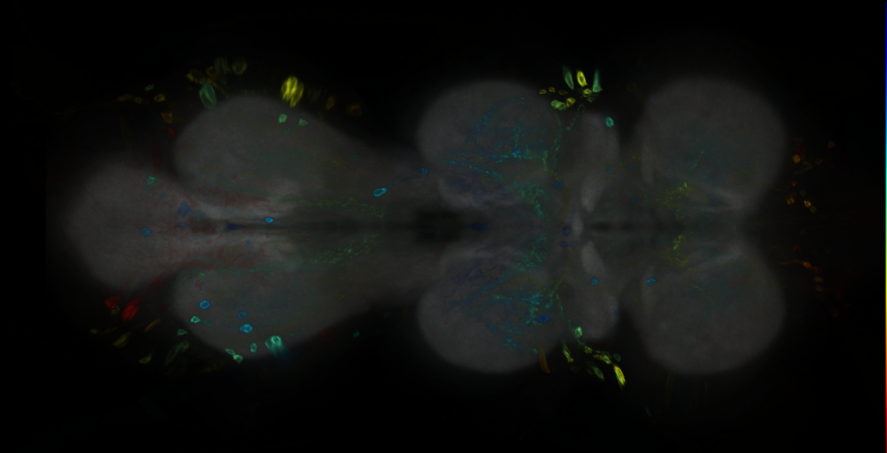 P{GMR18D07-GAL4} expression pattern