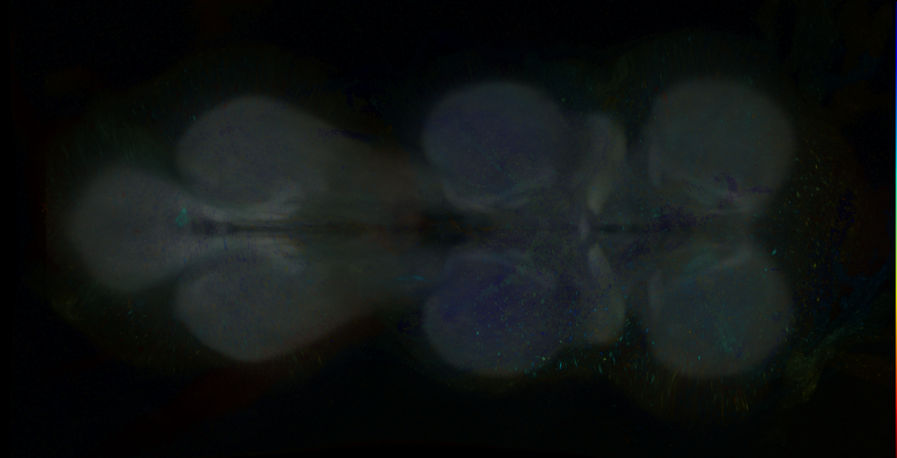 P{GMR18D08-GAL4} expression pattern