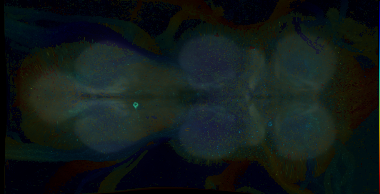 P{GMR18D10-GAL4} expression pattern