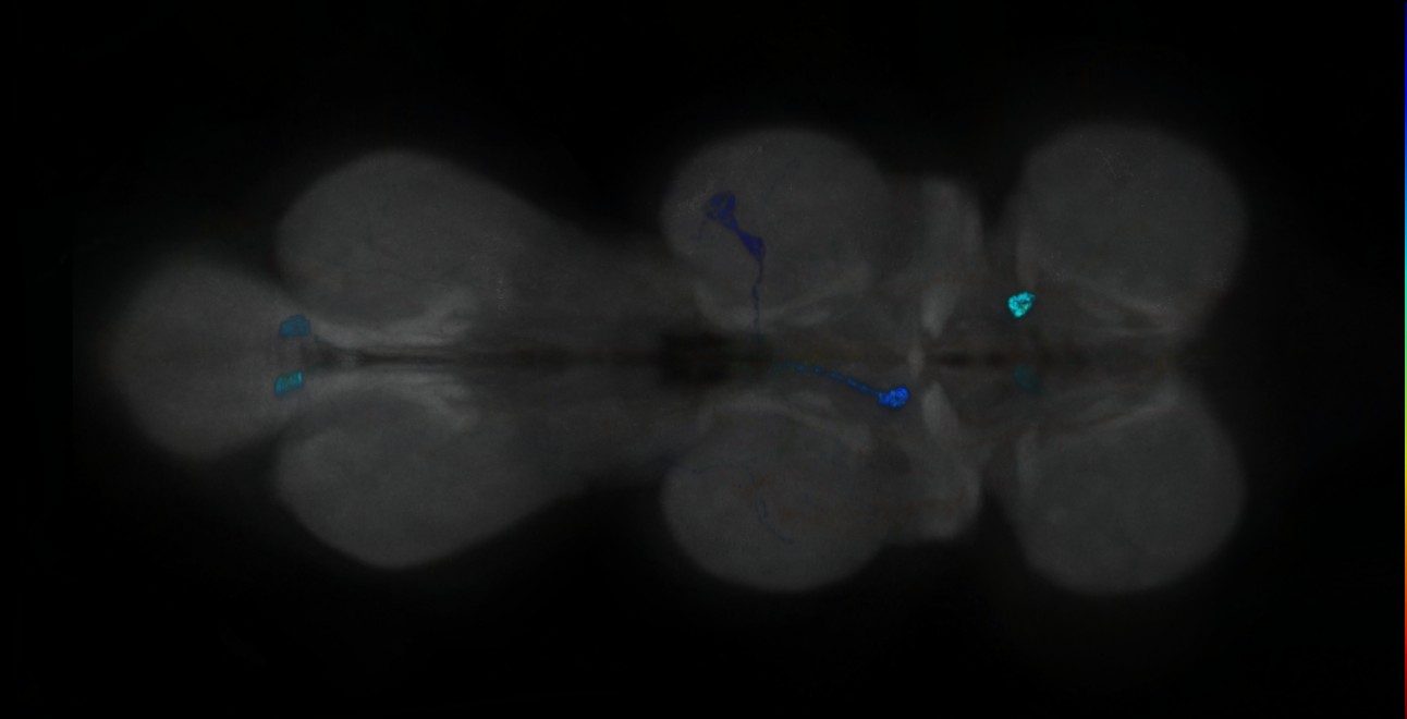 P{GMR18D11-GAL4} expression pattern
