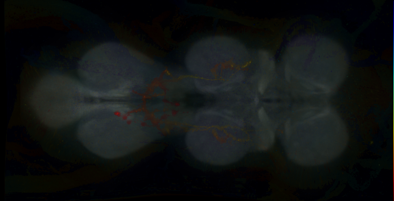 P{GMR18E02-GAL4} expression pattern